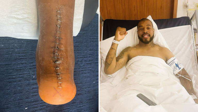 Ja si duket këmba e Kimpembes pas dëmtimit rrëqethës